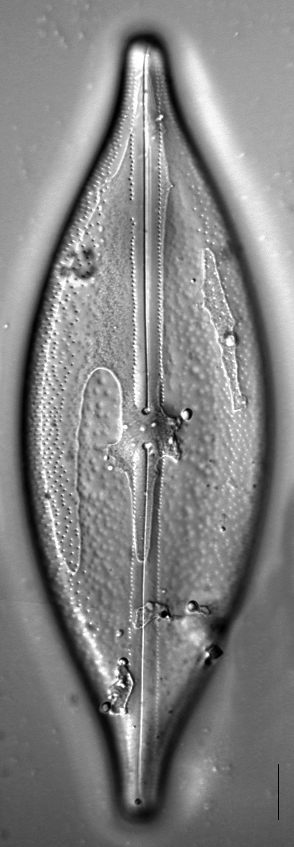 Anomoeoneis Sphaerophora F Sculpta Ill L 6 24 Image1