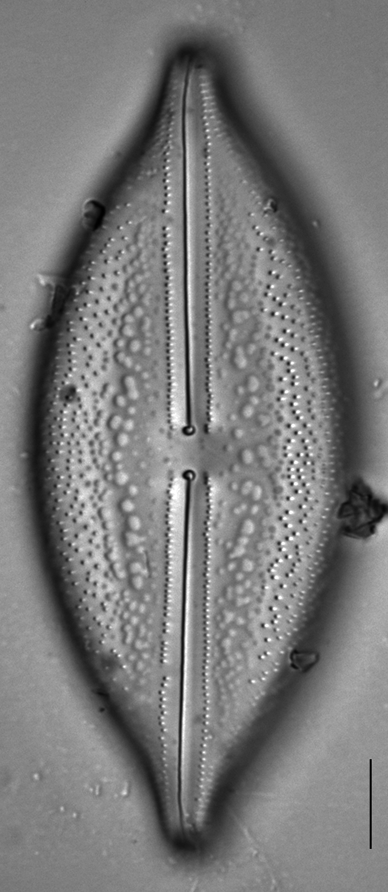 Anomoeoneis Sphaerophora F Sculpta Ill L 7 26 Image1