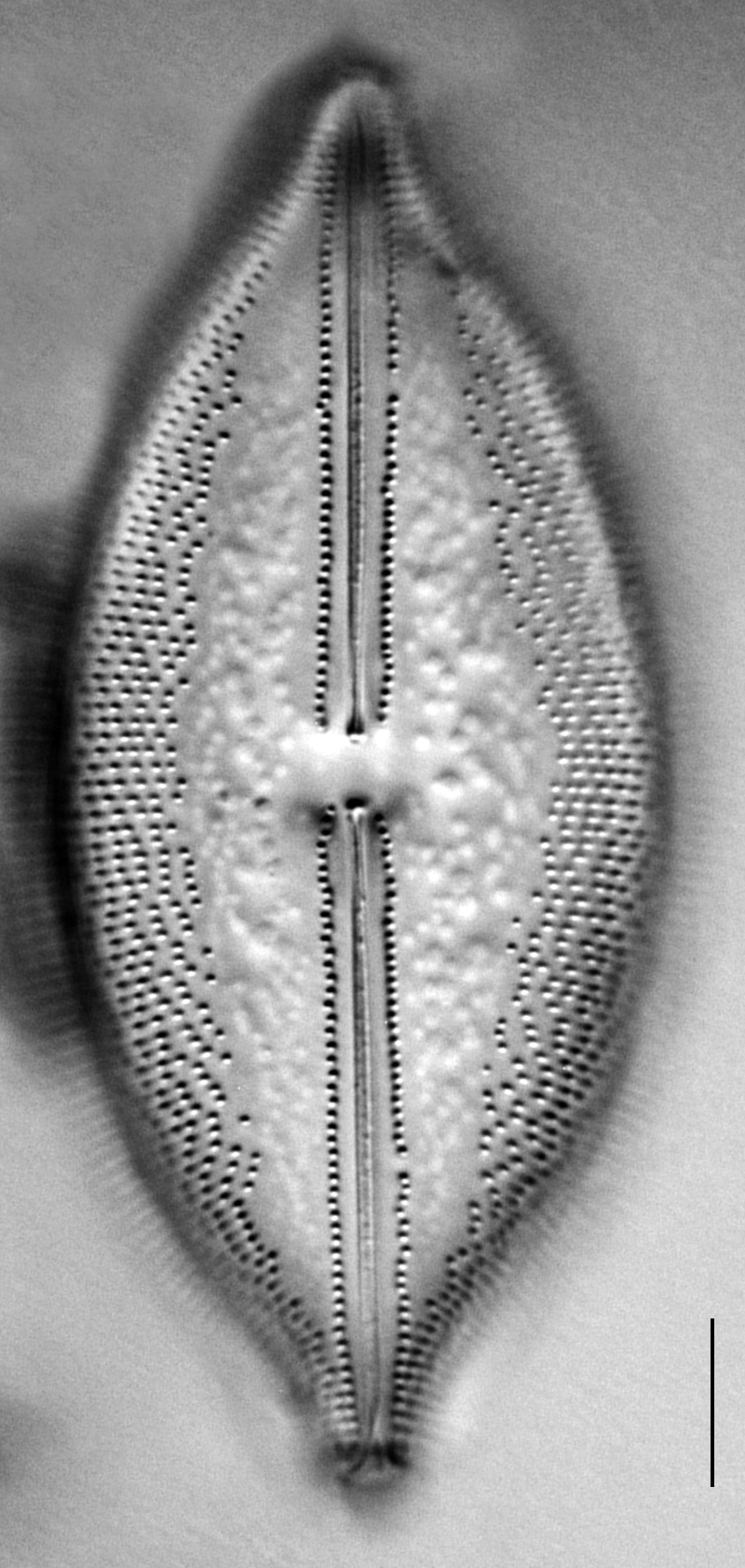 Anomoeoneis Sphaerophora F Sculpta Ill L 7 26 Image3