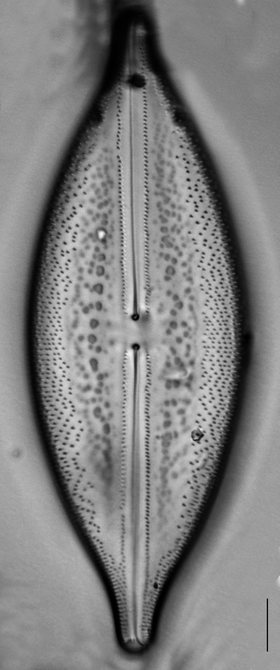 Anomoeoneis Sphaerophora F Sculpta Ill L 7 26 Image4