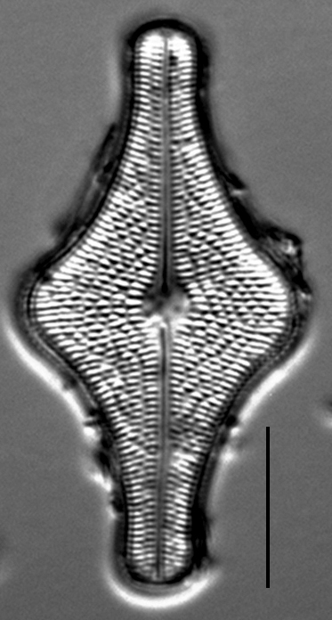 Brachysira follis LM6