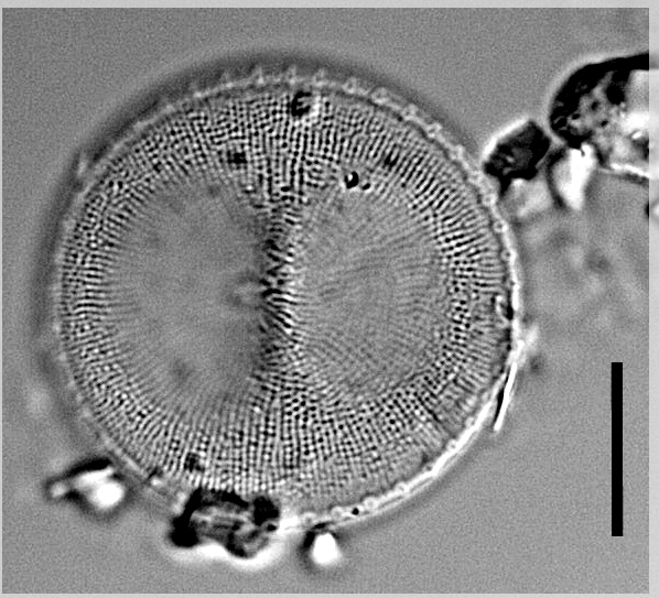 Ca 10035 06112018 21 Thalassiosira Gessneri Lm 01