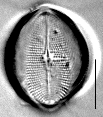 C Pediculus 11