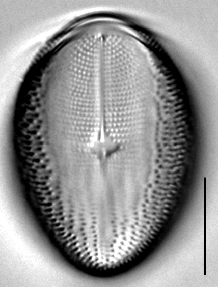 C Pediculus 14