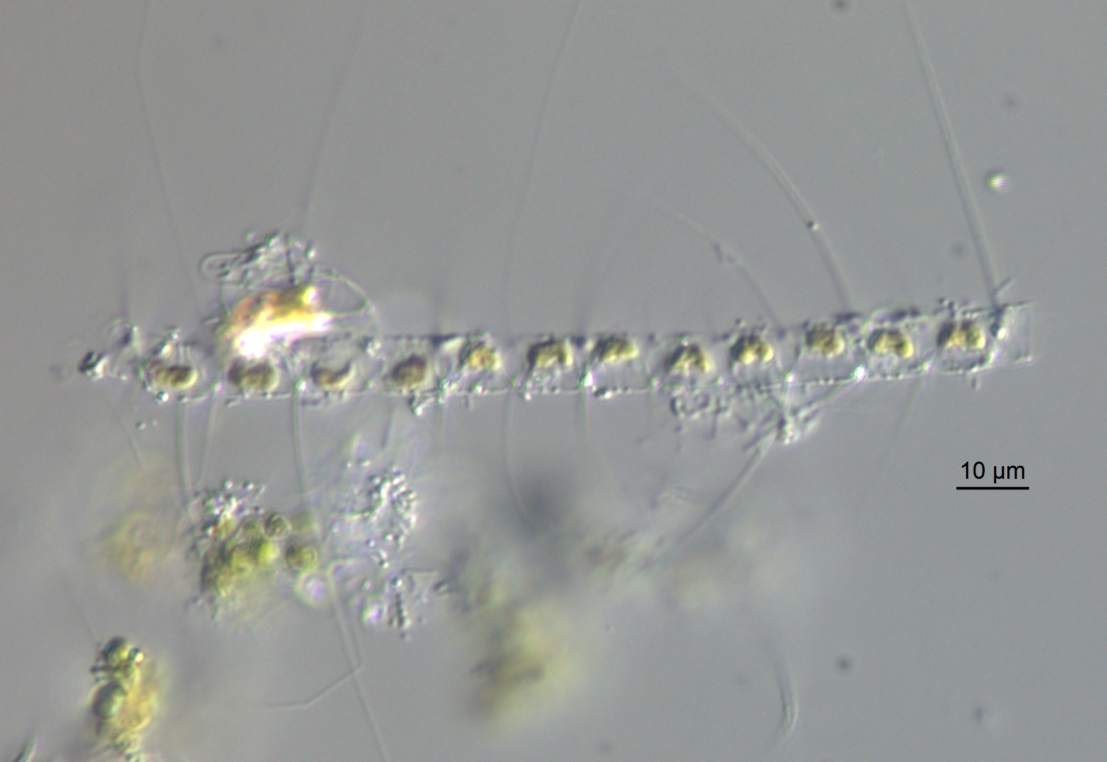 Chaetoceros constrictus LM1