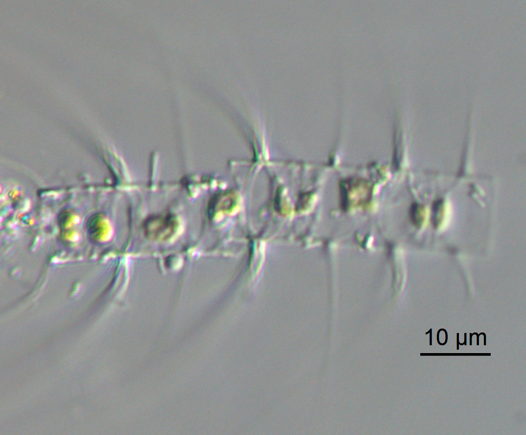 Chaetoceros constrictus LM3