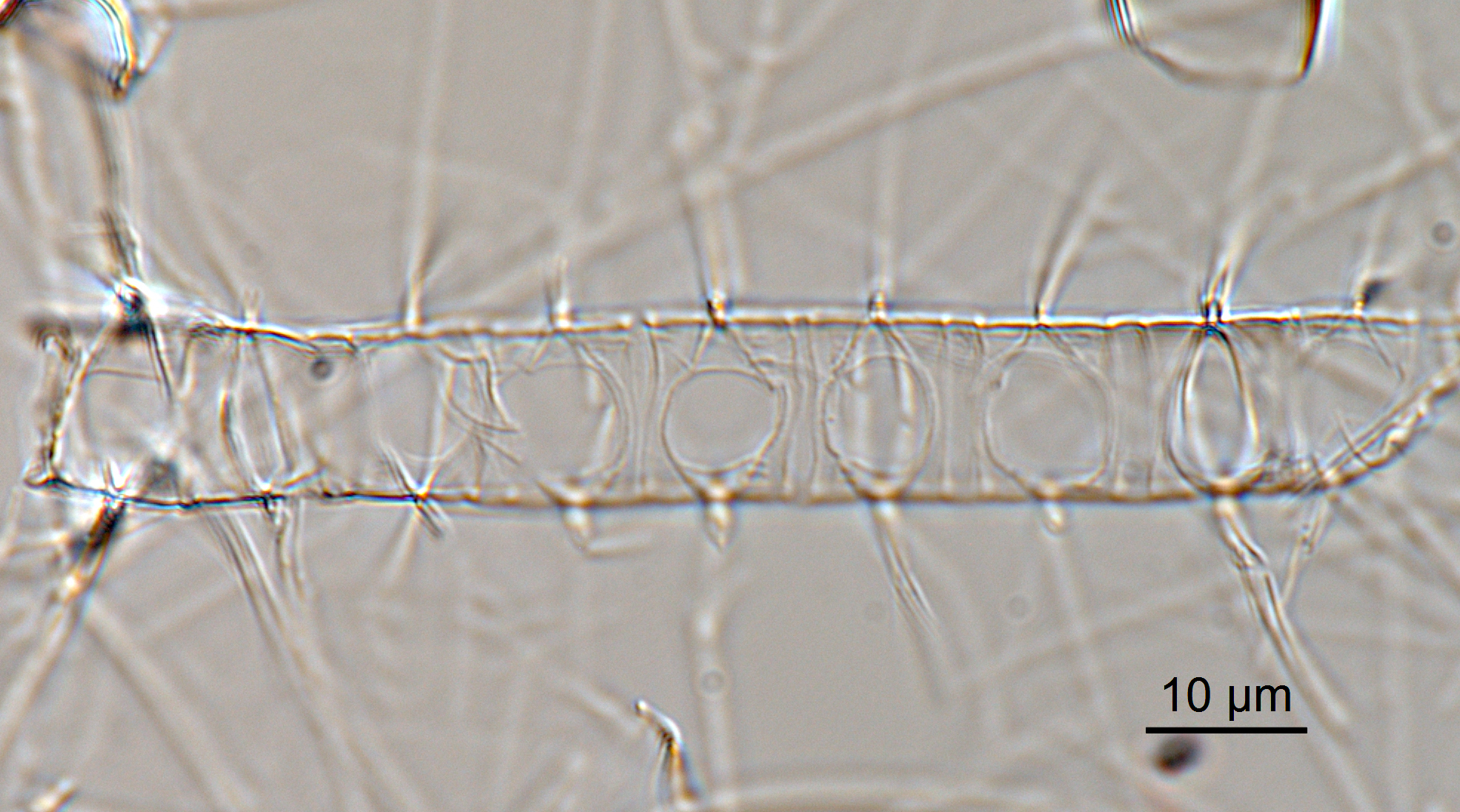 Chaetoceros constrictus LM4