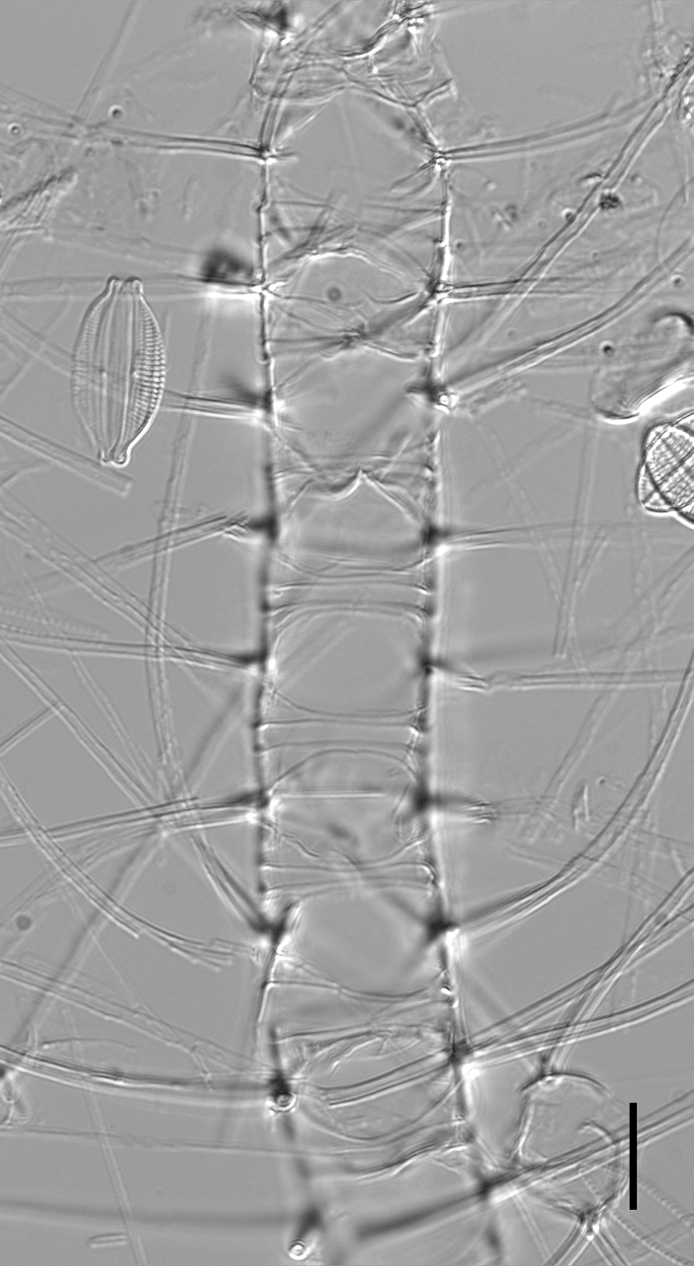 Chaetoceros constrictus LM5 copy