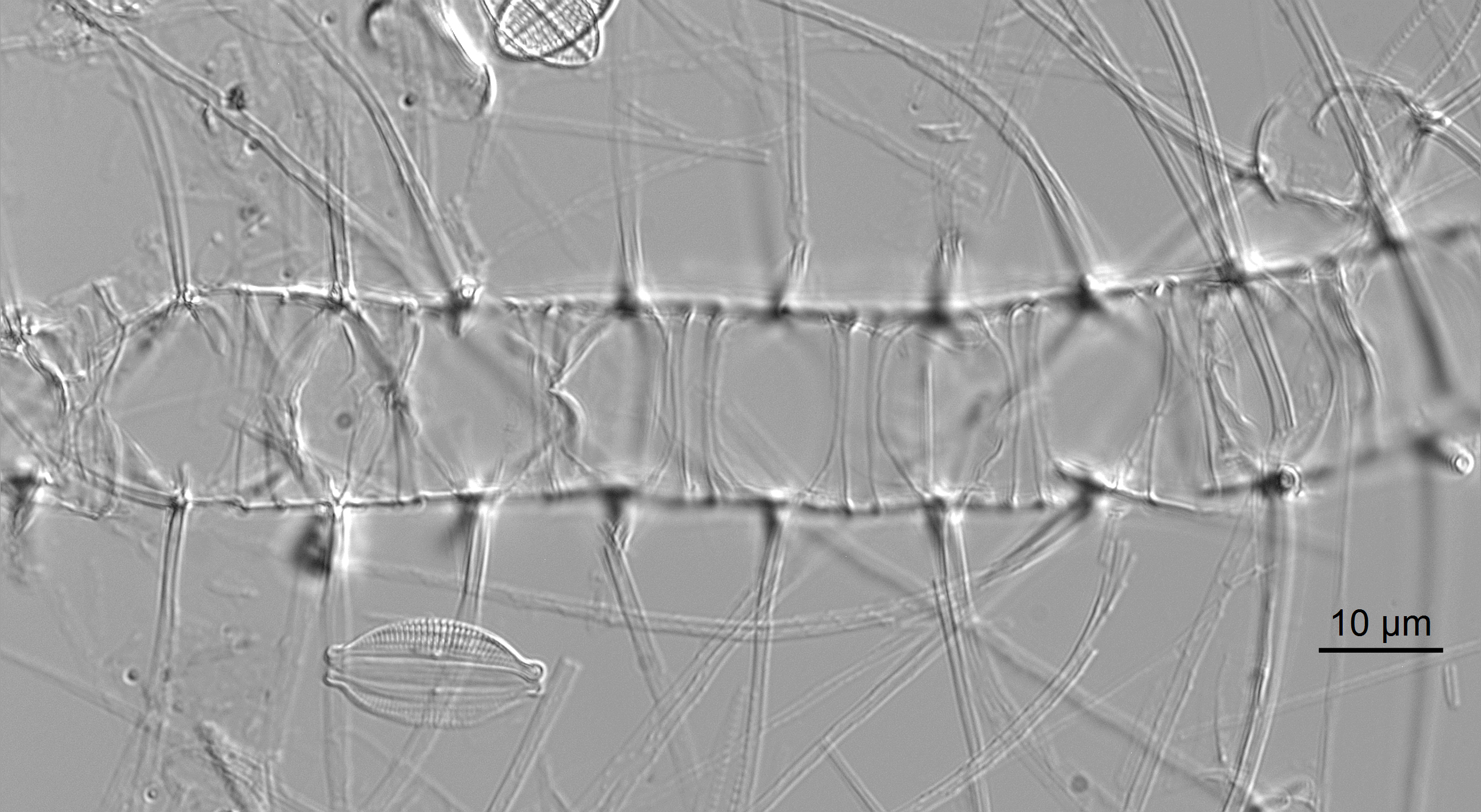 Chaetoceros constrictus LM5