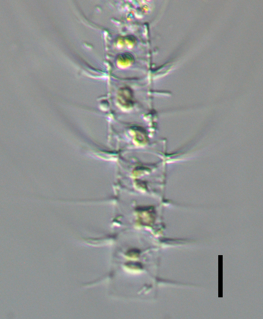 Chaetoceros constrictus LM3 copy