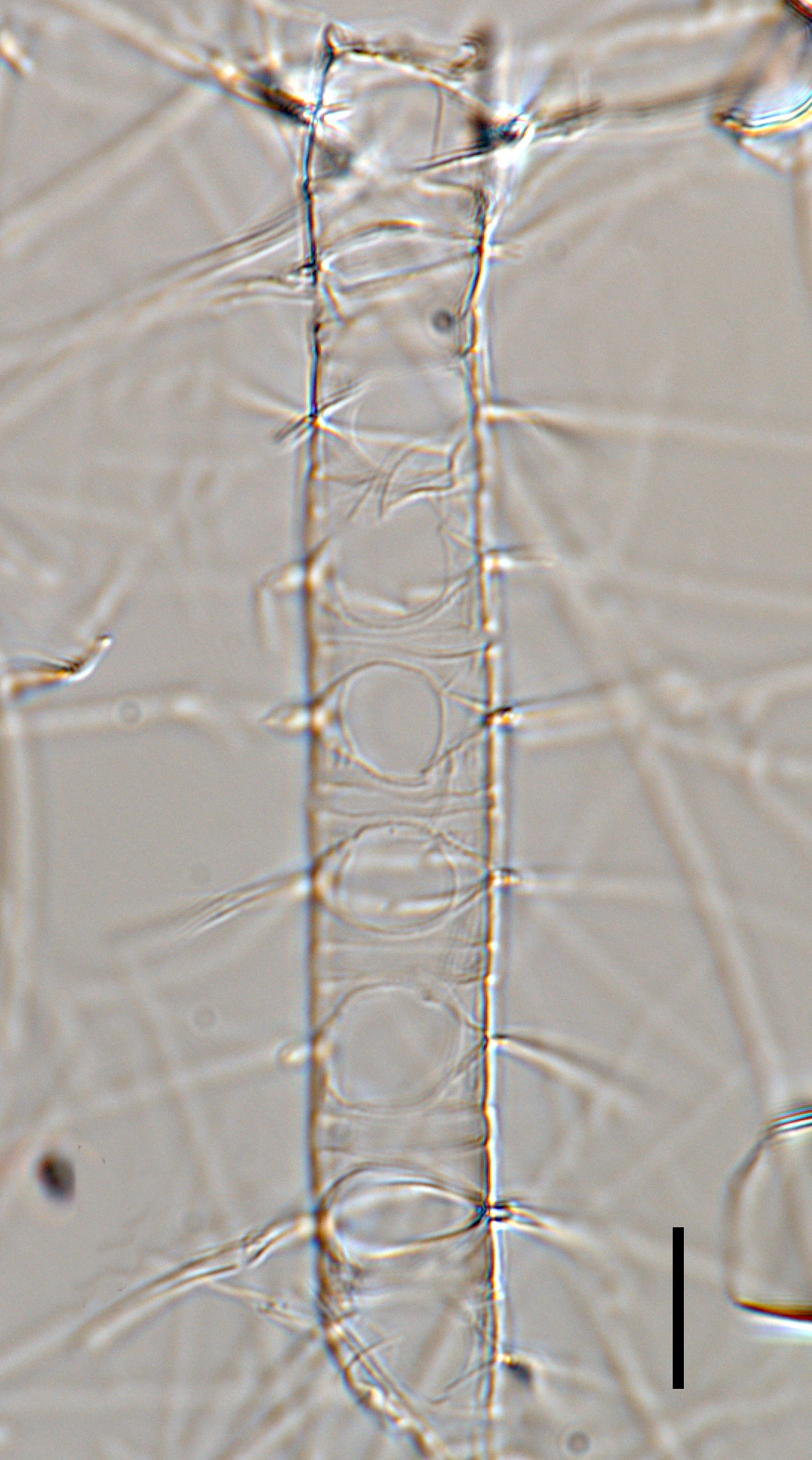 Chaetoceros constrictus LM4 copy