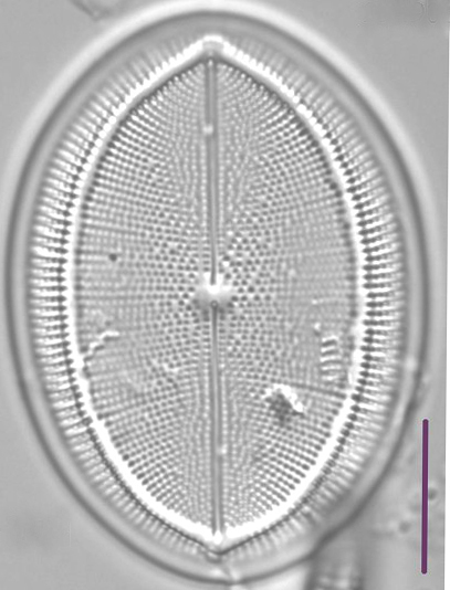 Cocconeis Grovei LM6