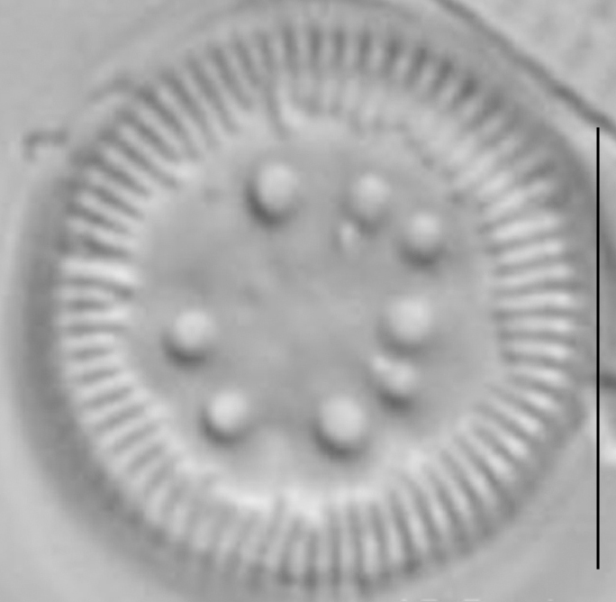 Cyclotella polymorpha LM1