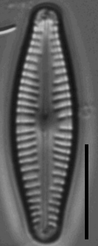 Cymbellafalsa diluviana LM 7