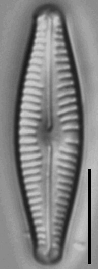 Cymbellafalsa diluviana LM1