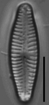 Cymbellafalsa diluviana LM2