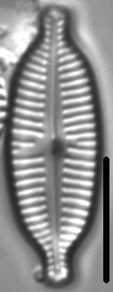 Cymbopleura Similiformis 6