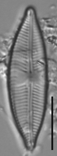 Cymbopleura Stauroneiformis  Wet Ak443 Final