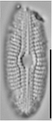 Diploneis fontanella LM4