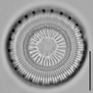 Discostella asterocostata LM7