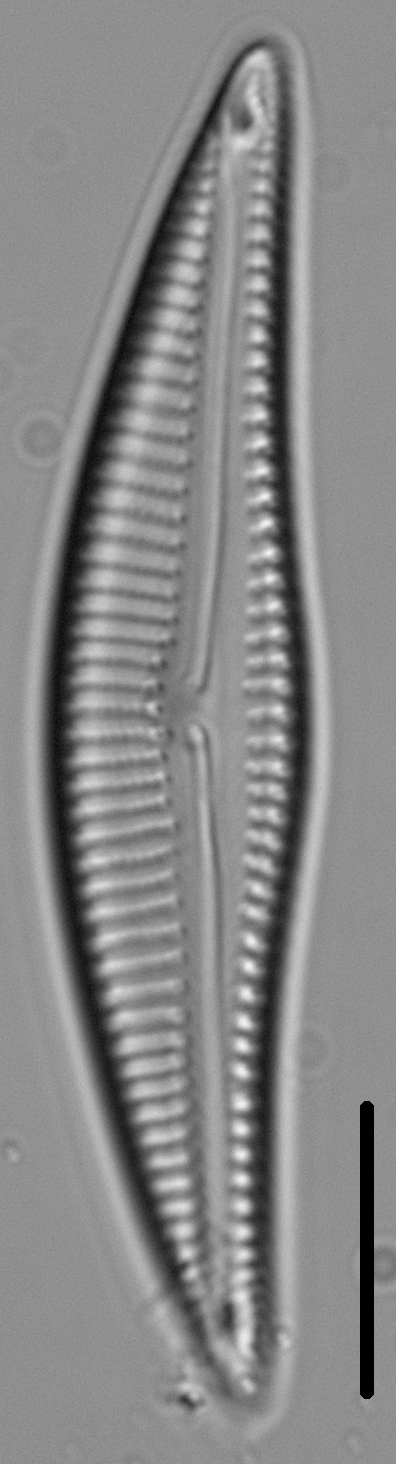 Encyonema silesiacum var elegans LM1