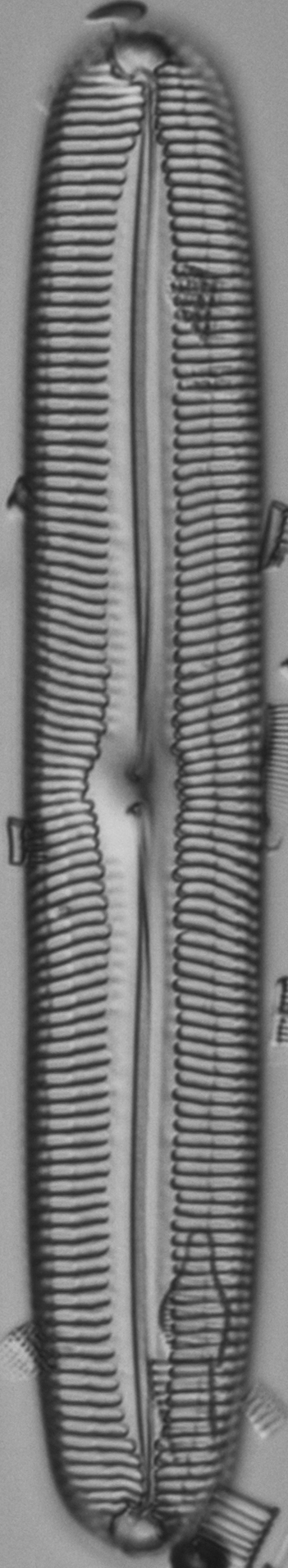 Pinnularia spinifera EM100012 TYPE8