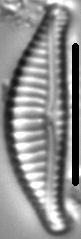 Encyonema fogedii LM1