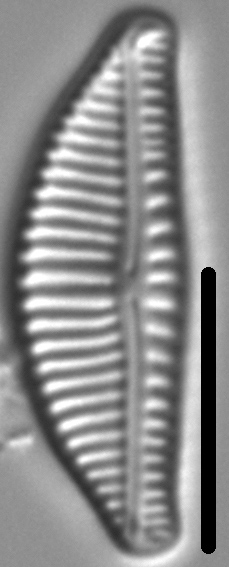 Encyonema latecapitatum LM1