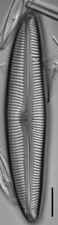 Encyonema neomesianum 07062021 SRS1d EC3 Fig2