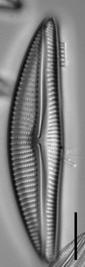 Encyonema neomesianum 07062021 SRS1d EC3 Fig4