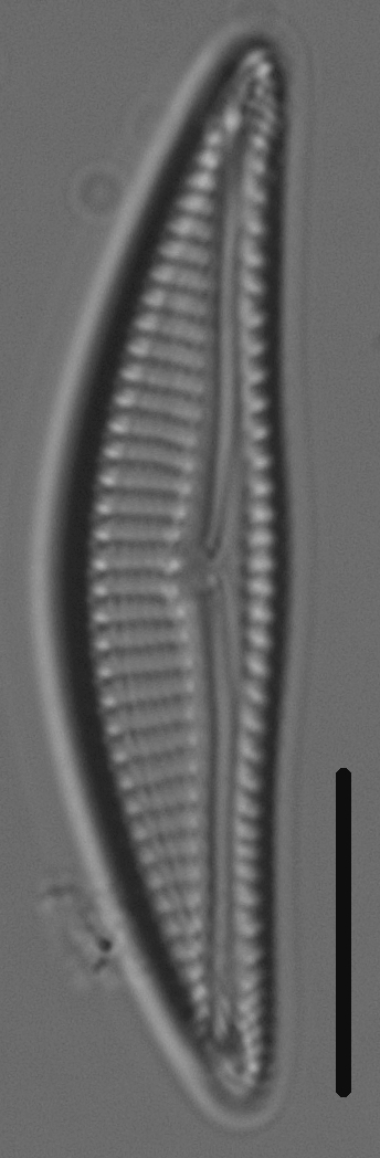 Encyonema silesiacum var elegans LM3