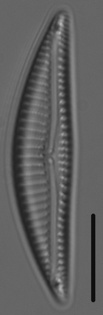 Encyonema silesiacum var elegans LM4