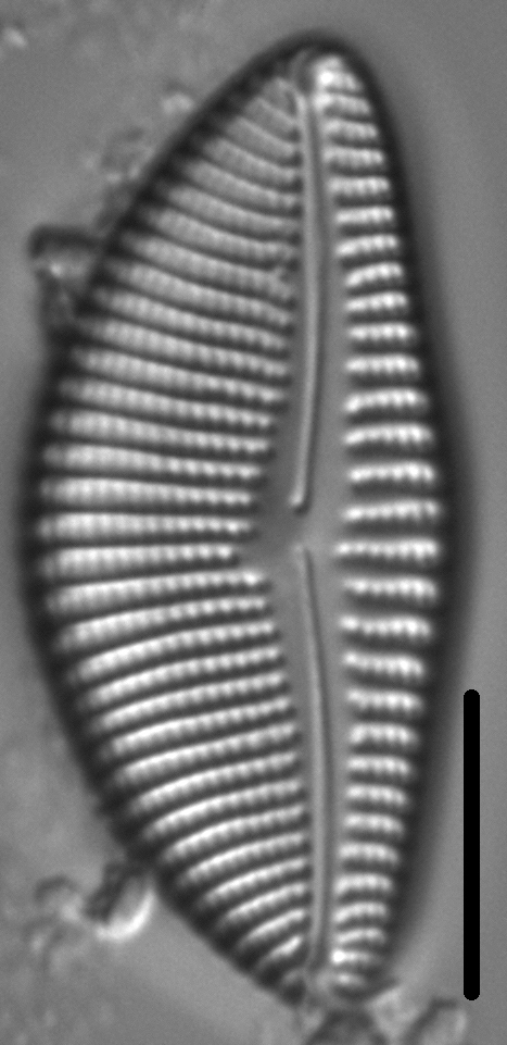 Encyonema sinicum LM6