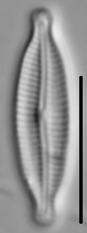 Encyonemopsis Microcephala 006