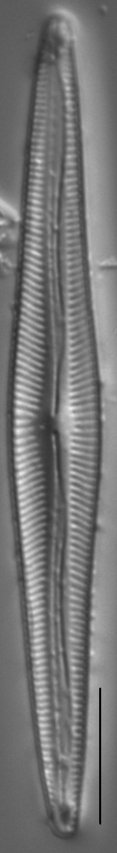 Encyonopsis Subspicula2