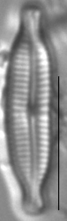 Encyonopsis microcephala sensu Krammer LM6