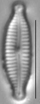 Encyonopsis microcephala sensu Krammer LM3