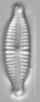 Encyonopsis microcephala sensu Krammer LM4