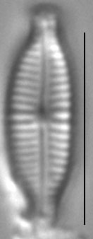 Encyonopsis microcephala sensu Krammer LM5