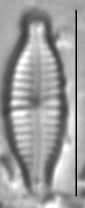 Encyonopsis microcephala sensu Krammer LM7