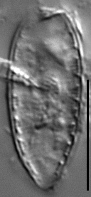Surirella stalagma LM6