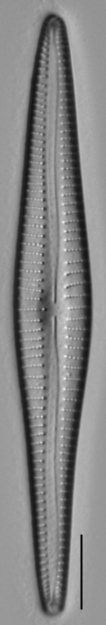 Gomphonema Intricatum Var Vibrio Lm1