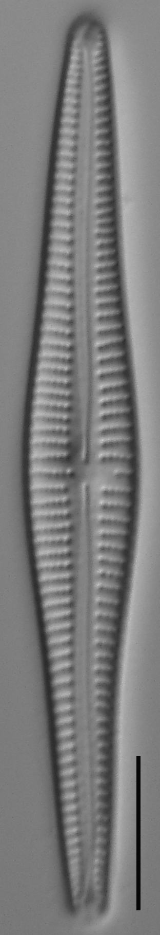 Gomphonema Intricatum Var Vibrio Lm3