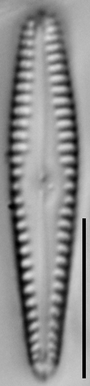 Gomphonema sierranum LM5