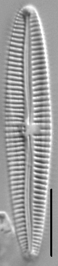 Gomphonema multipunctatum LM2