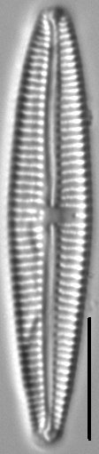 Gomphonema multipunctatum LM4