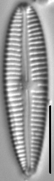 Gomphonema multipunctatum LM5