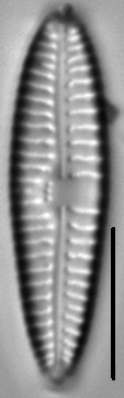 Gomphonema multipunctatum LM6