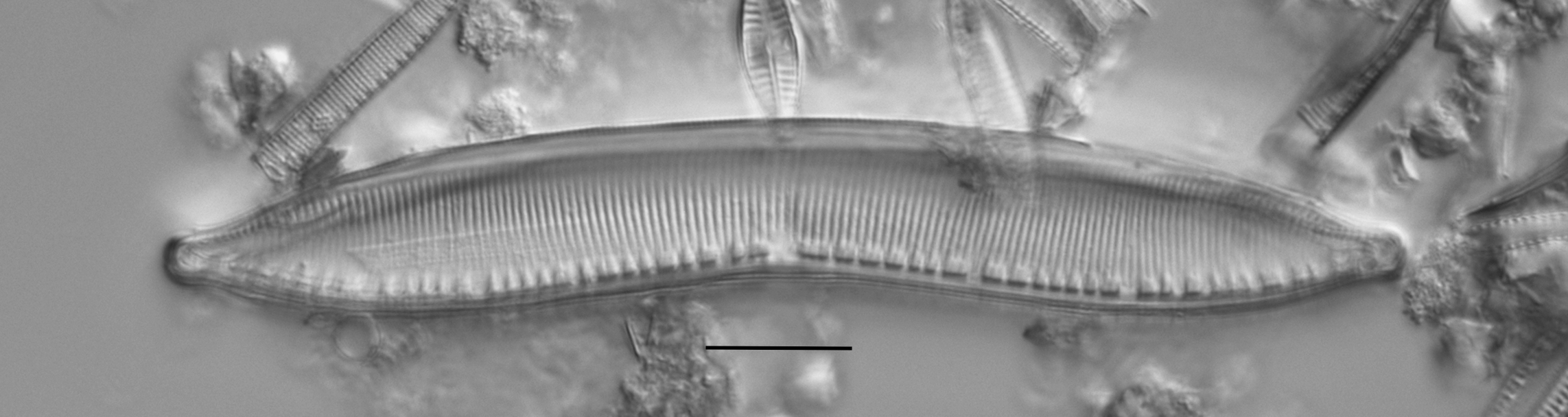 Haduplicate Amphioxys Gc61088 004