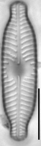 Placoneis paraelginensis LM7